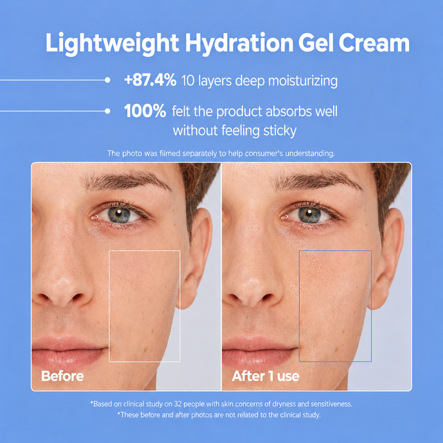 AESTURA Atobarrier 365 Hydro Soothing Cream lightweight hydration gel cream before and after results for dry sensitive skin
