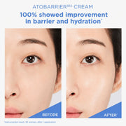 AESTURA Travel Size ATOBARRIER365 Cream Moisturizer 30ml | Ceramide Barrier Repair Cream - Korean OTC